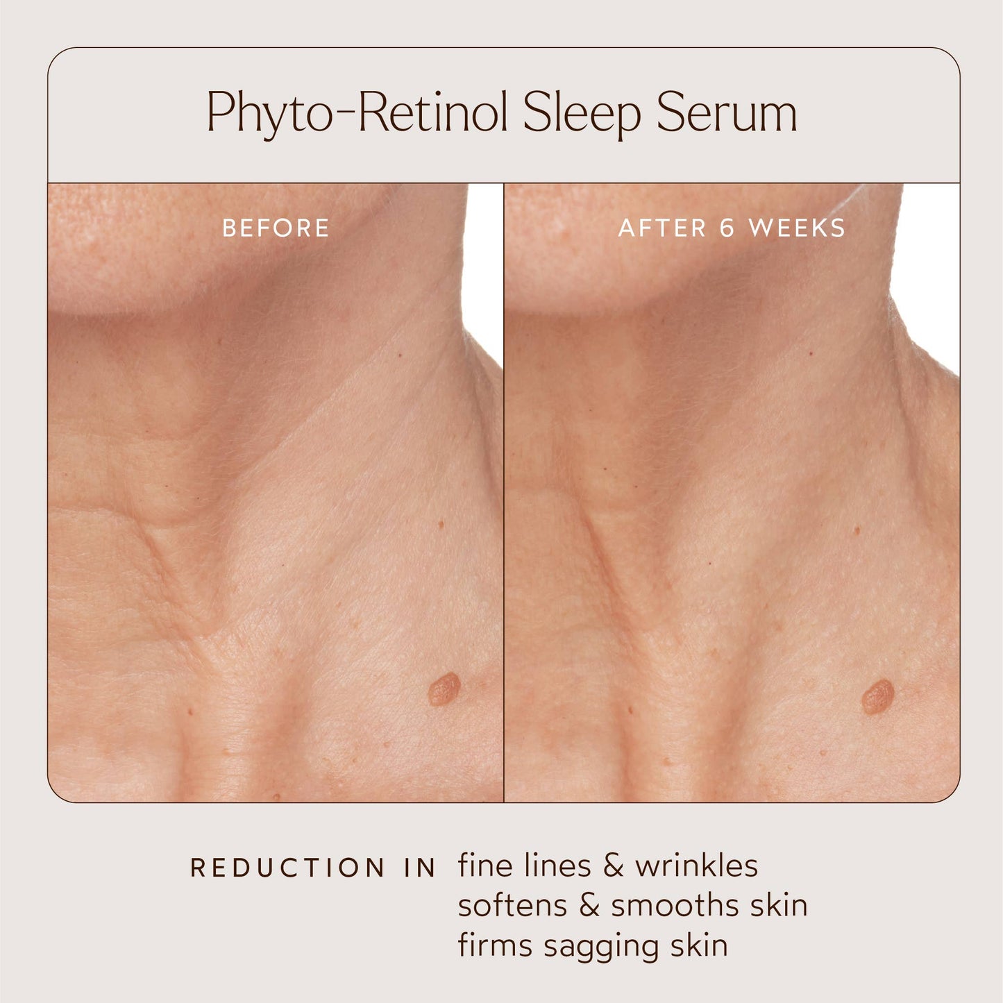 Phyto Retinol Anti-Aging Sleep Serum